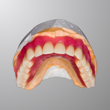 Full Denture/<br>Temporary Dentures