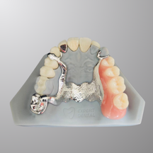 CCP Dentures